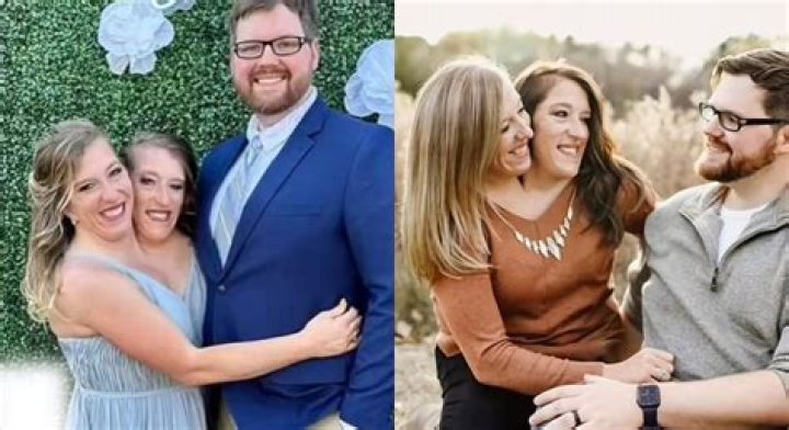 The Tragic Story Of Abby And Brittany Hensel: A Family's Loss