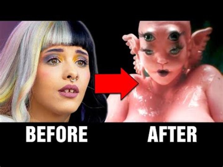 Melanie Martinez's Boob Job Rumors Explored