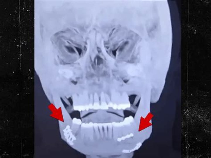 Unveiling The Truth: Jake Paul's Family Status Revealed