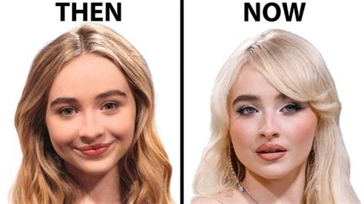 Uncovering The Truth: Has Sabrina Carpenter Undergone Surgery?