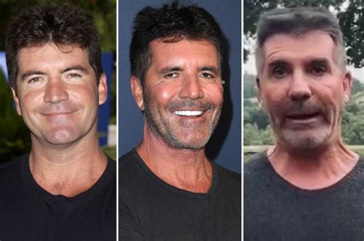 Uncovering The Truth: Is Simon Cowell Battling Cancer?