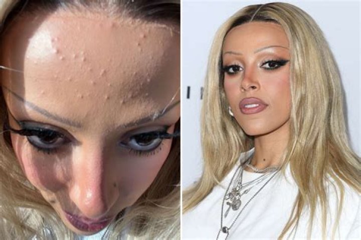 Unveiling The Truth And Controversy: Doja Cat's Controversial Beauty