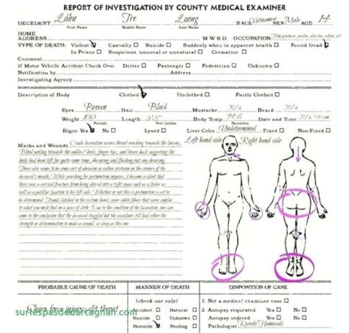 Deep Dive Into The Gianna Bryant Autopsy