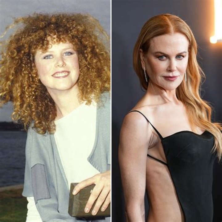 Unveiling The Truth: Nicole Kidman's Plastic Surgery Journey