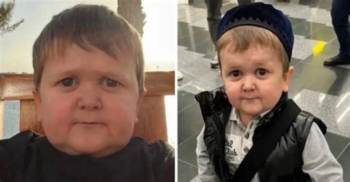 How Old Is Hasbulla Right Now? His Age Revealed