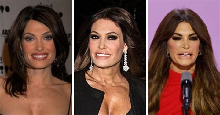 Kimberly Guilfoyle's Transformation: Before And After Pics Unveiled