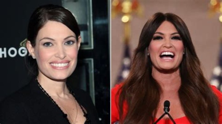 Unveiling Kimberly Guilfoyle's Journey: Before And After Surgery