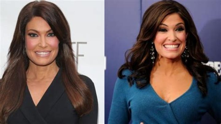 Kimberly Guilfoyle's Stunning Transformation: Unveiling The Secrets Of Her Face Lift