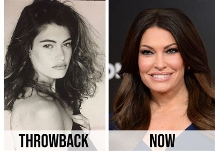 Kimberly Guilfoyle's Plastic Surgery Journey: A Transformation Uncovered