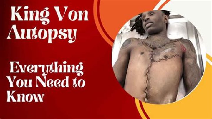 The Secret Investigation: King Von Autopsy Paper Uncovered