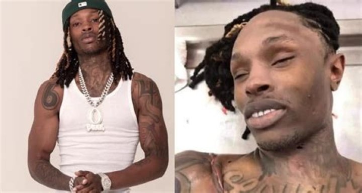 Probing King Von's Cause Of Death: An Autopsy Unraveled