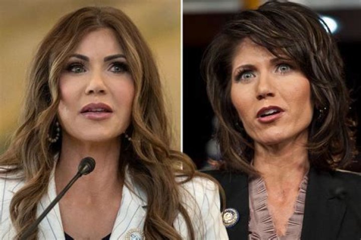 Before And After Surgery: The Transformation Of Kristi Noem