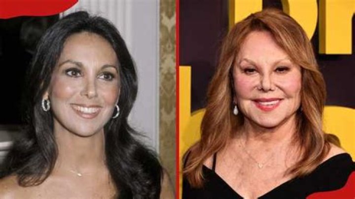 Marlo Thomas's Nose Job: Uncovering The Untold Story