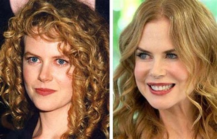 The Truth About Nicole Kidman's Nose Job: Before And After Transformation