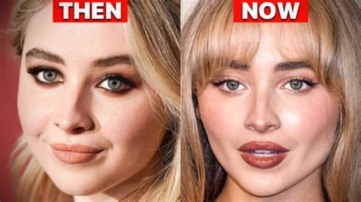 Sabrina Carpenter's Transformation: The Truth About Her Plastic Surgery