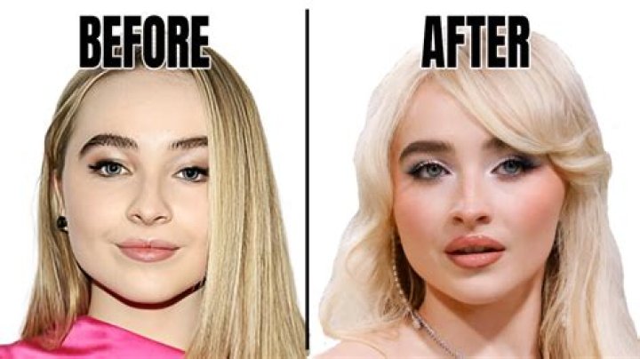 Marvelous Facial Evolution: The Transformation Of Sabrina Carpenter