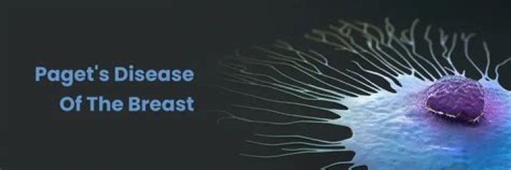 Where Does Paget Brewster Reside? Unveiling The Actress's Abode